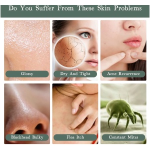 Calendula Soap for skin problems